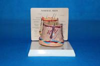 桌上型病态圆皮肤 