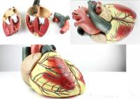 超音波心脏解剖模型