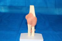 肘关节带粉红色韧带 