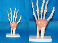 手关节带粉红色韧带