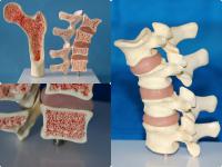 中型脊椎和股骨 