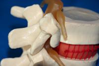 大型脊椎受压力模型 