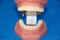 自然大树脂牙28牙 