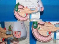 桌上型胆结石和脾胰模型 