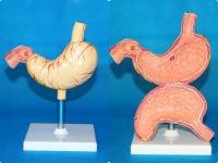 胃溃疡模型（二点） 