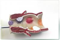 直肠的病理模型