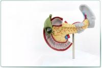 胰脾十二指肠病变模型