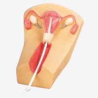 IUD放置训练模型