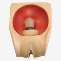 进阶女性避孕器训练模型