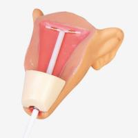 IUD放置训练模型