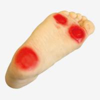 糖尿病足部护理模型